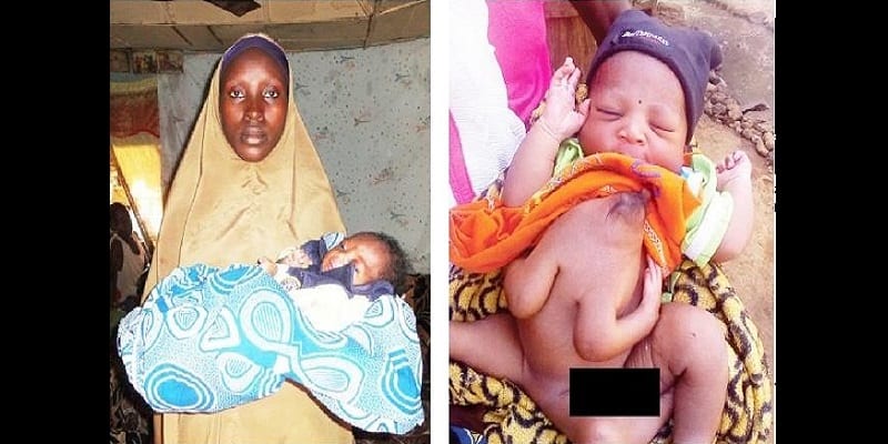 Nigeria Insolite Elle Donne Naissance A Un Bebe Avec Quatre Mains Et Trois Jambes