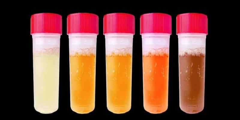 Voici Ce Que La Couleur De Votre Urine Révèle Sur Votre état