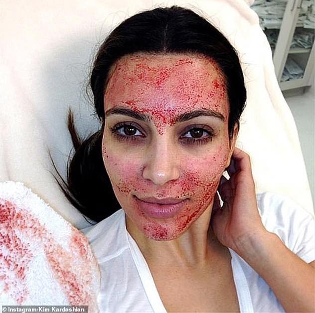 Kim Kardashian intente un procès contre un médecin esthétique