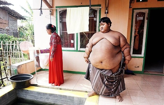 Arya Permana : découvrez comment l’enfant le plus gros du monde a perdu plus de la moitié de son poids (photos)