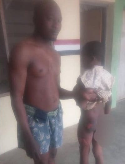 Nigeria: un jeune garçon brûlé avec un fer à repasser chaud par un clerc islamique