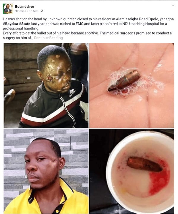Nigeria: Il vomit une balle logée dans sa tête des mois après avoir été tiré dessus