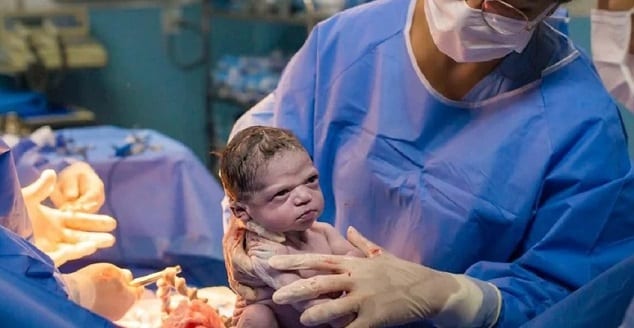 Un photographe réussit à capturer le moment où un nouveau-né fronce les sourcils devant le médecin
