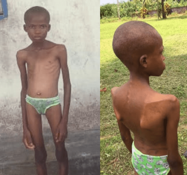 Nigeria : une fille de 13 ans enfermée et torturée par sa mère après qu’un prophète a affirmé qu'elle est possédée par un démon (photos)