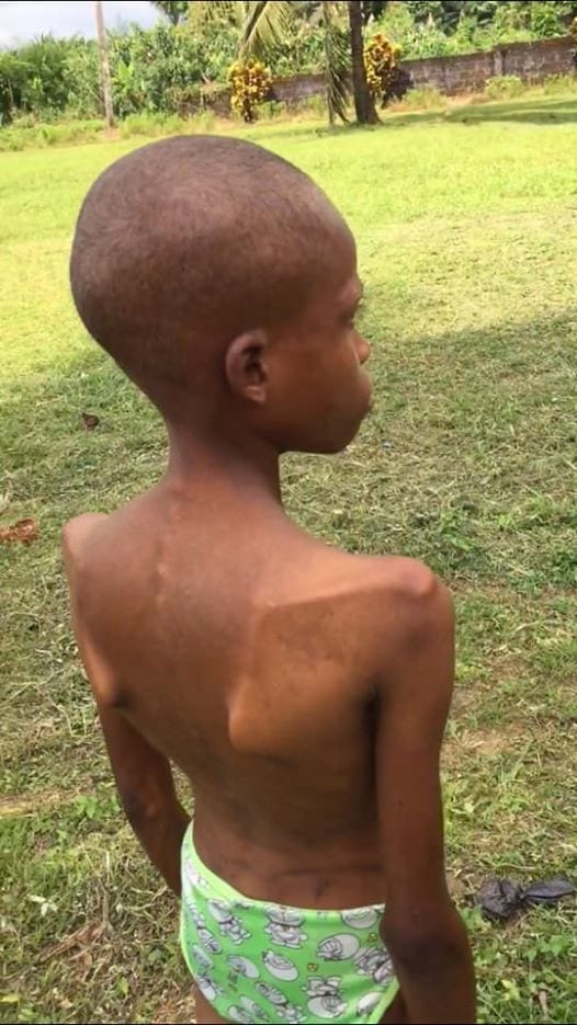 5e6f504695a3b - Nigeria : une fille de 13 ans enfermée et torturée par sa mère après qu’un prophète a affirmé qu’elle est possédée par un démon (photos)