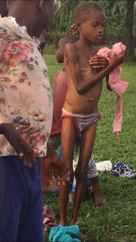 5e6f50cb24aa0 - Nigeria : une fille de 13 ans enfermée et torturée par sa mère après qu’un prophète a affirmé qu’elle est possédée par un démon (photos)
