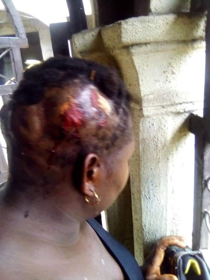 Nigeria: en colère, un homme brise la tête de sa femme avec un pilon