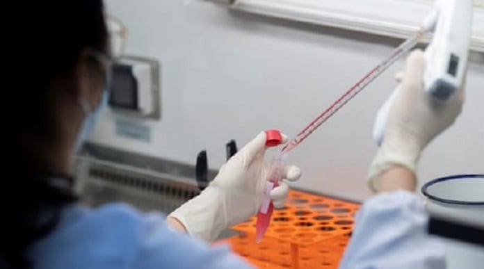 Coronavirus : les essais d'un nouveau vaccin sur l'homme  débuteront ce jeudi en Angleterre