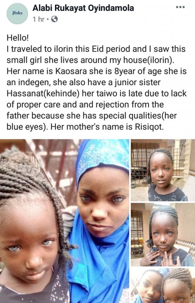 Nigeria: un homme aurait rejeté sa fille parce qu'elle a des yeux bleus (Photos)