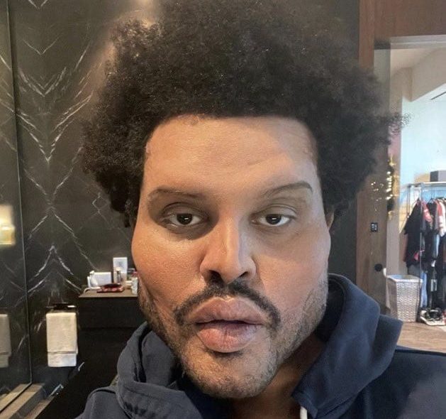 The Weeknd surprend avec un look bizarre dans son nouveau clip, internet s’inquiète